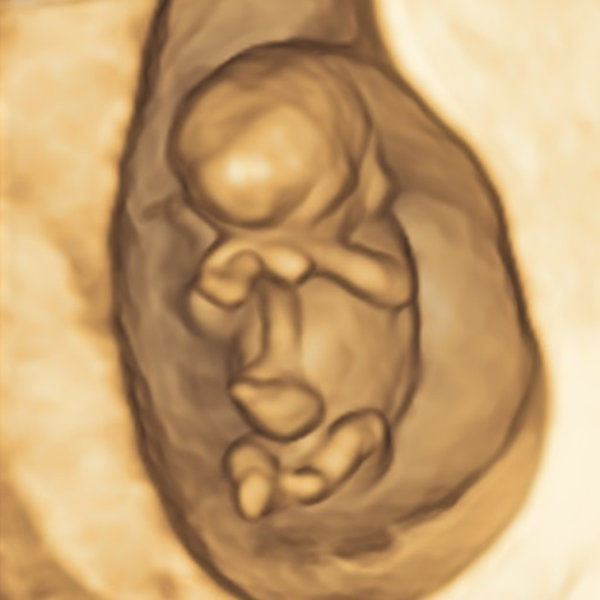 embryo